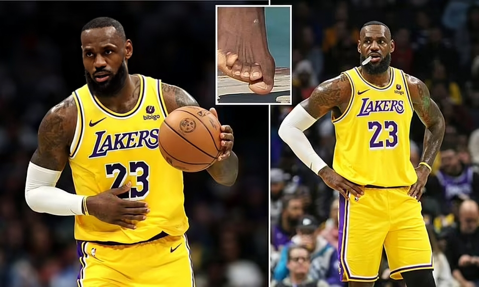 LeBron James’ feet photo resurfaces and goes viral as fans realise wear and tear of 21-year NBA career